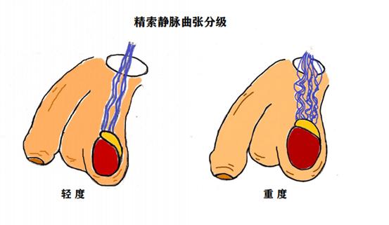 男科守护男性健康，幸福生活从此起航